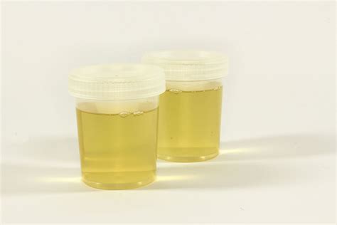 urine test for weed